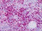 MPO / Myeloperoxidase Antibody